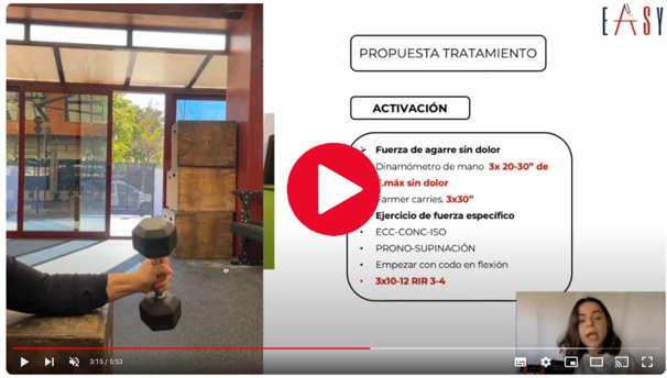 
El dolor lateral de codo, comúnmente conocido como codo de tenista, es una afección dolorosa causada por inflamación en los tendones del antebrazo.
