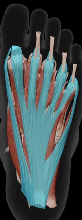 La fascitis plantar es una patología habitual la cual cursa con dolor en el talón debido a una inflamación de la fascia plantar.
