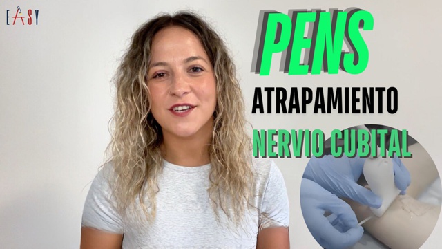 La neuropatía por compresión del nervio cubital, síndrome del túnel cubital, causa gran incomodidad y limita la función del brazo y la mano