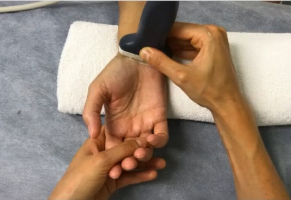 Corte transversal de referencia tunel del carpo