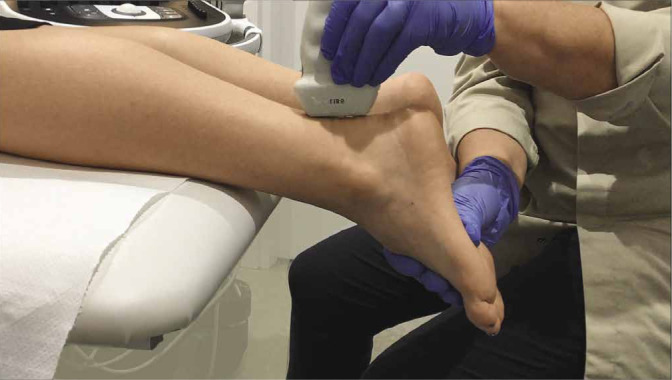 Exploracion dinamica ecografica tendon Aquiles - posicion