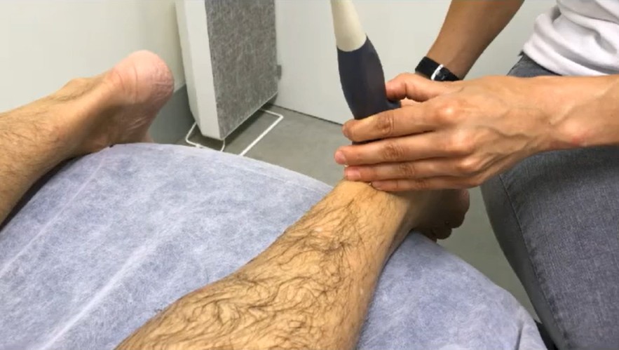 Posicion paciente exploracion tendon aquiles ecografia