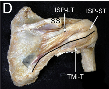 Disección del hombro que muestra la anatomía del tendón supraespinoso Disección del hombro que muestra la anatomía del tendón supraespinoso y su fusión con otras estructuras