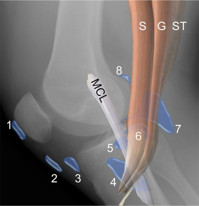 recuerdo anatomico bursas rodilla