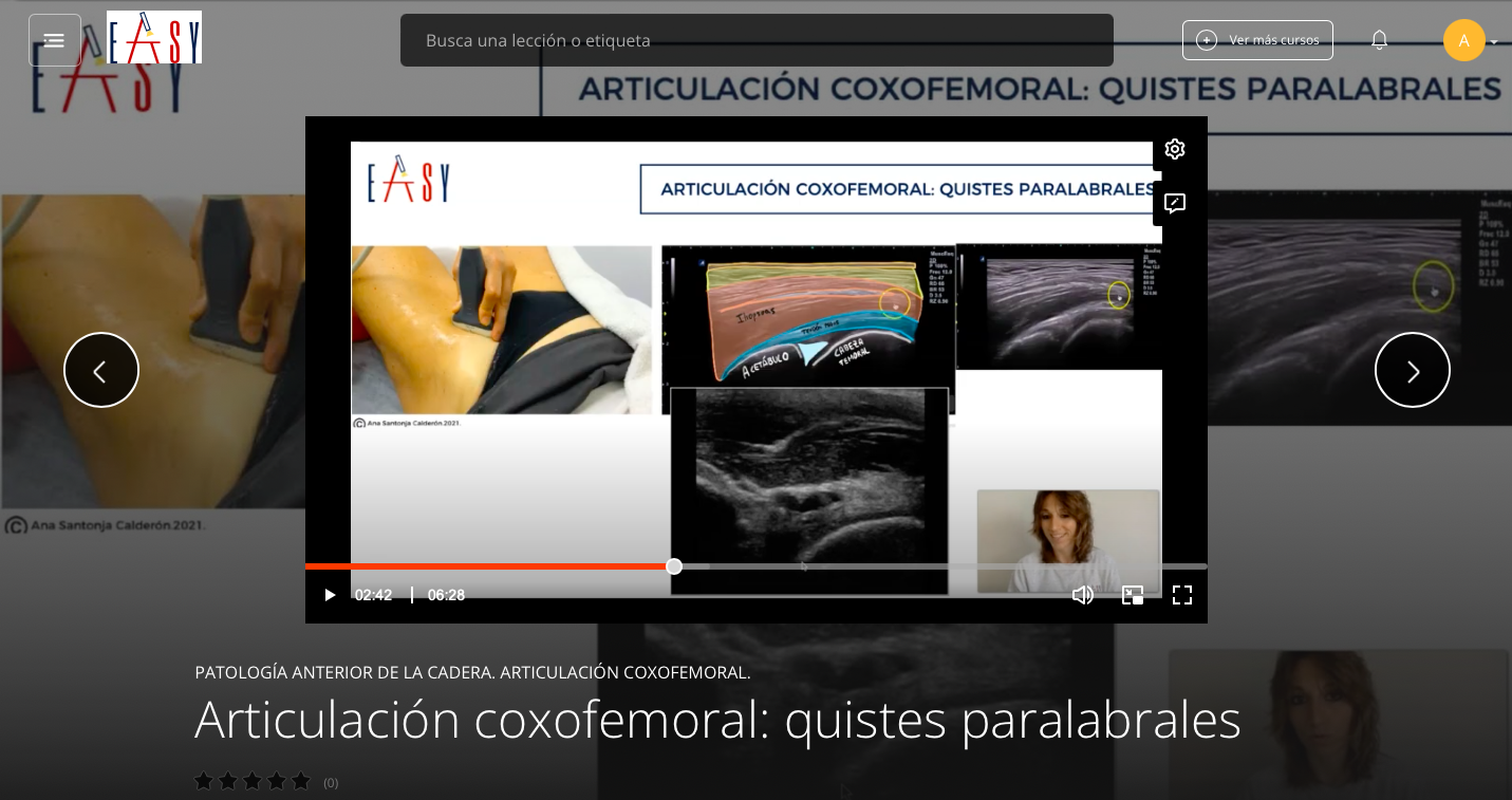 Patología Anterior de la Cadera
