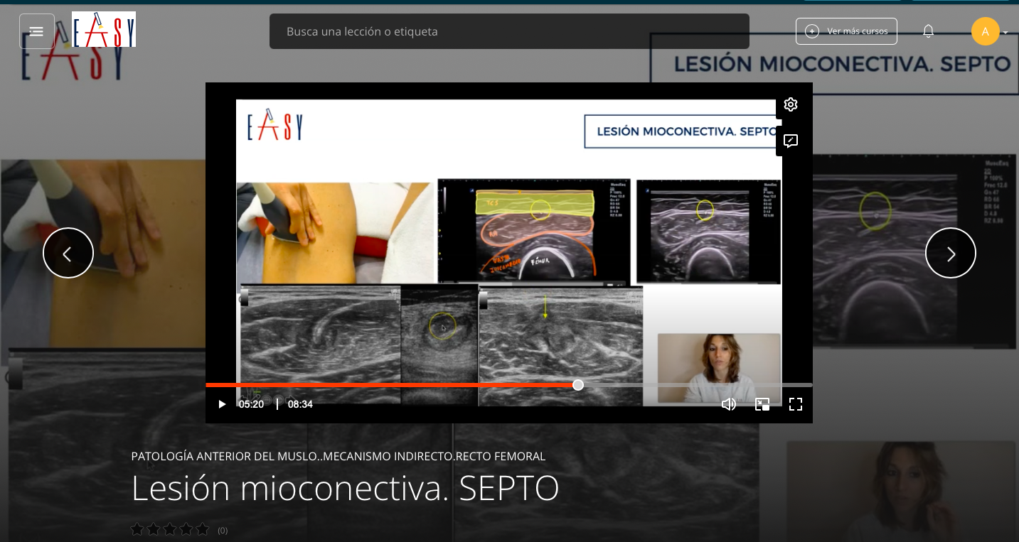 Patología Anterior del Muslo