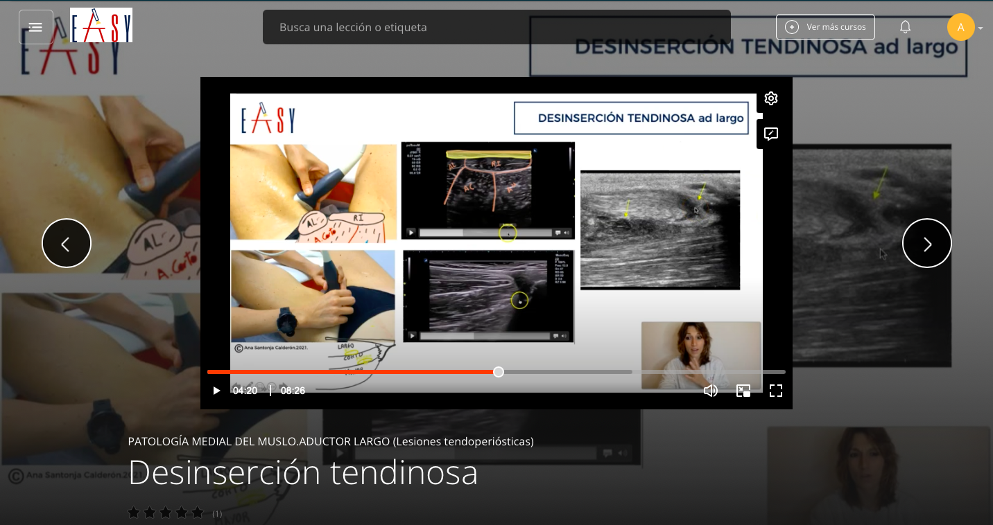 Patología Medial del Muslo