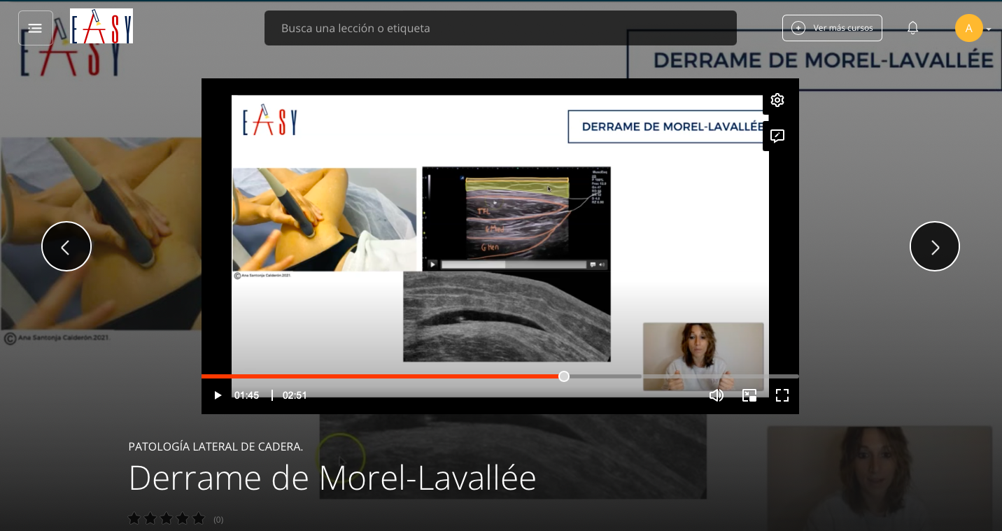 Patología Lateral de Cadera