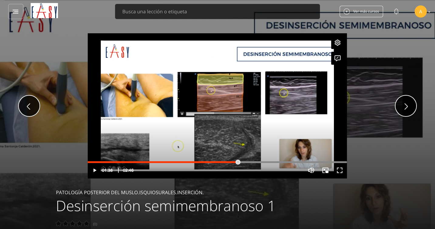 Patología Posterior Cadera y Muslo