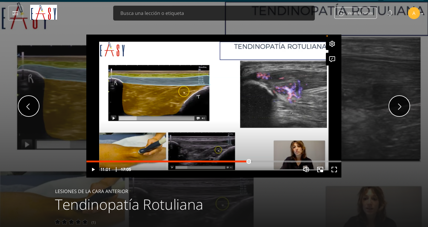 Patología Cara Anterior
