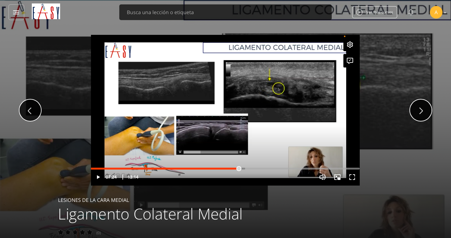 Patología Cara Medial