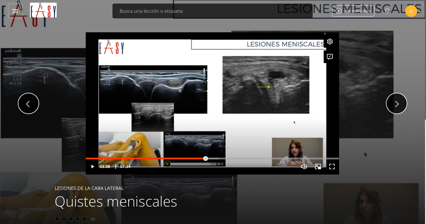 Patología Cara Lateral