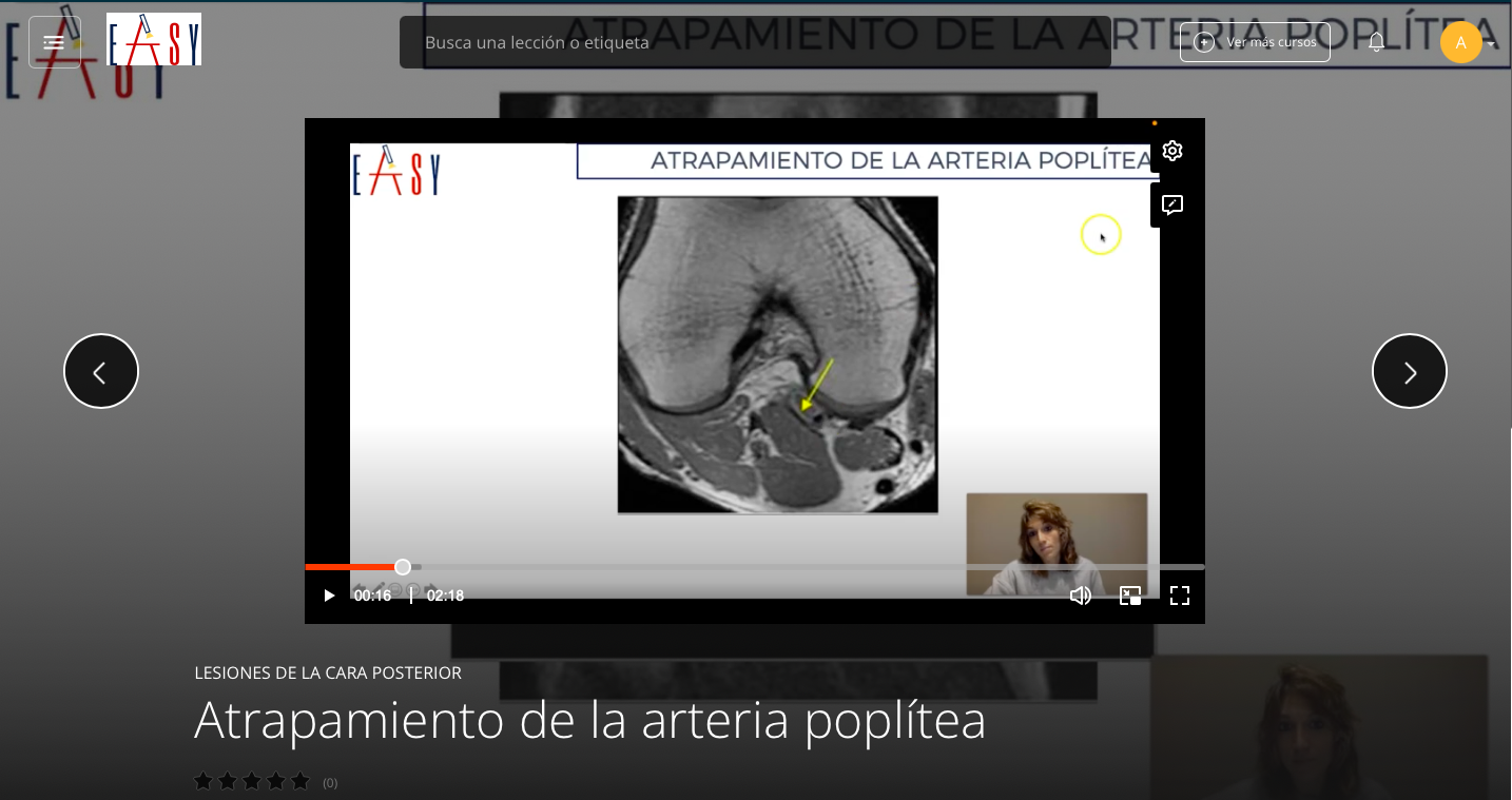 Patología Cara Posterior