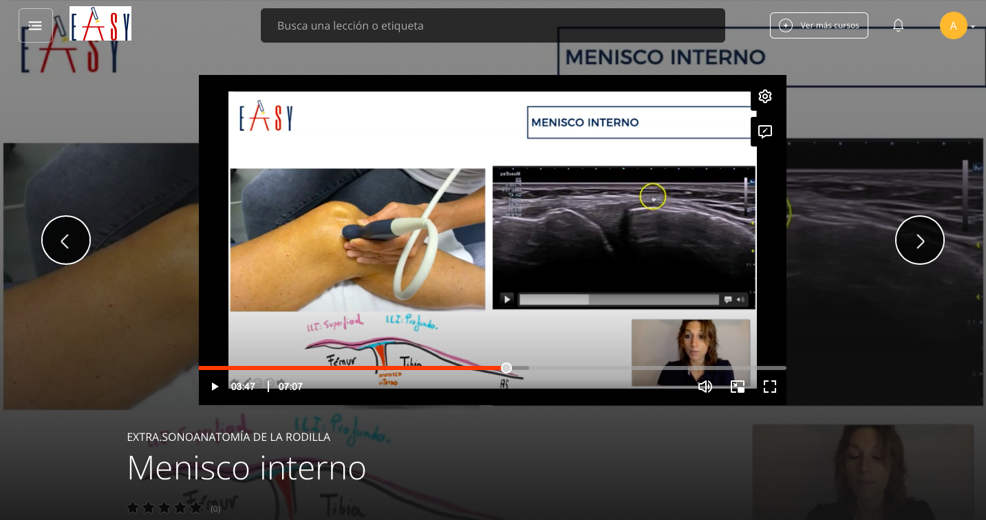 4 Exploraciones de Rodilla Formación Easy TOP Ecografía
