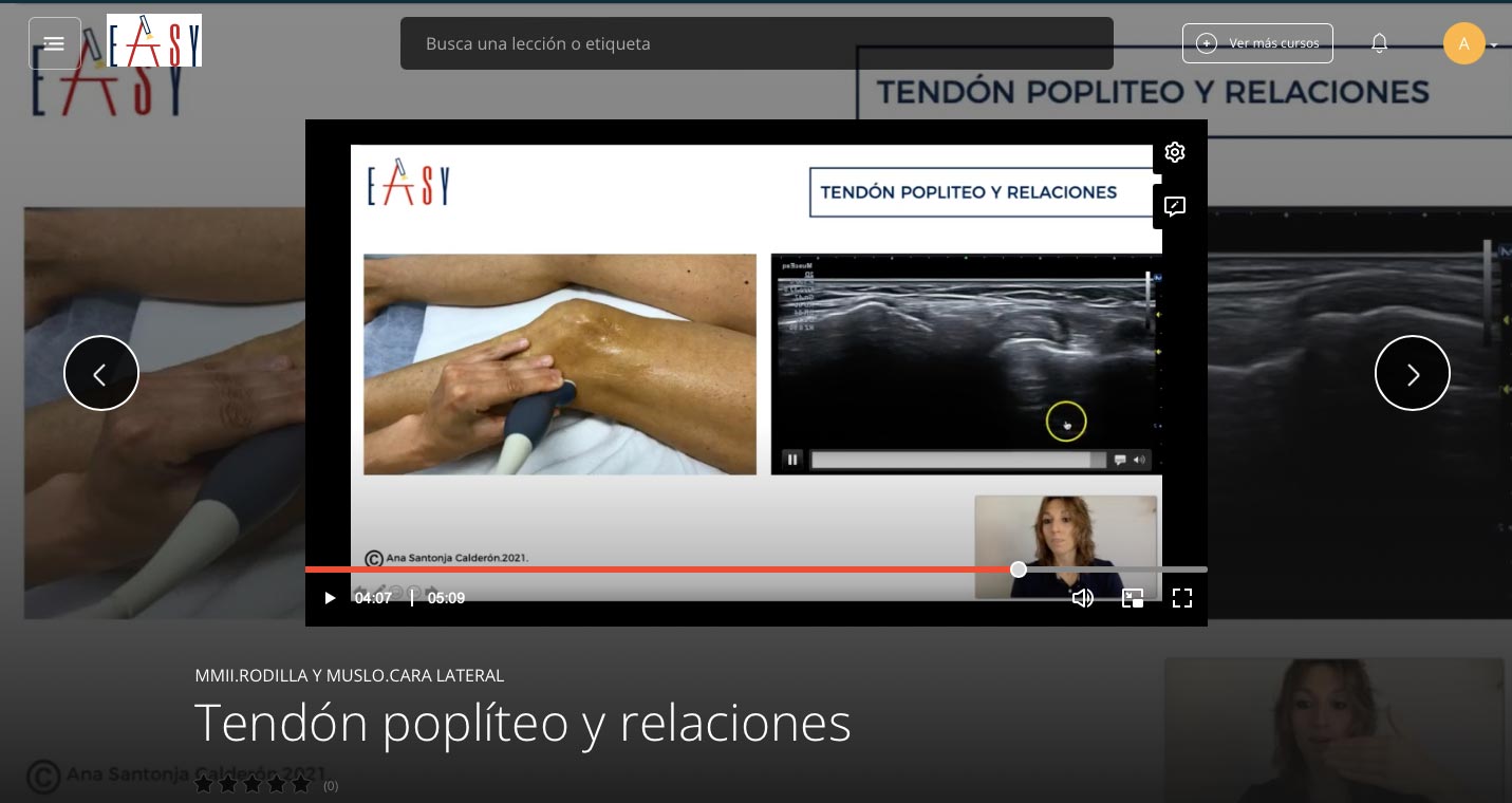 Rodilla y Muslo