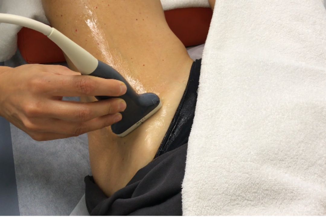  ecografía patológica cadera y muslo