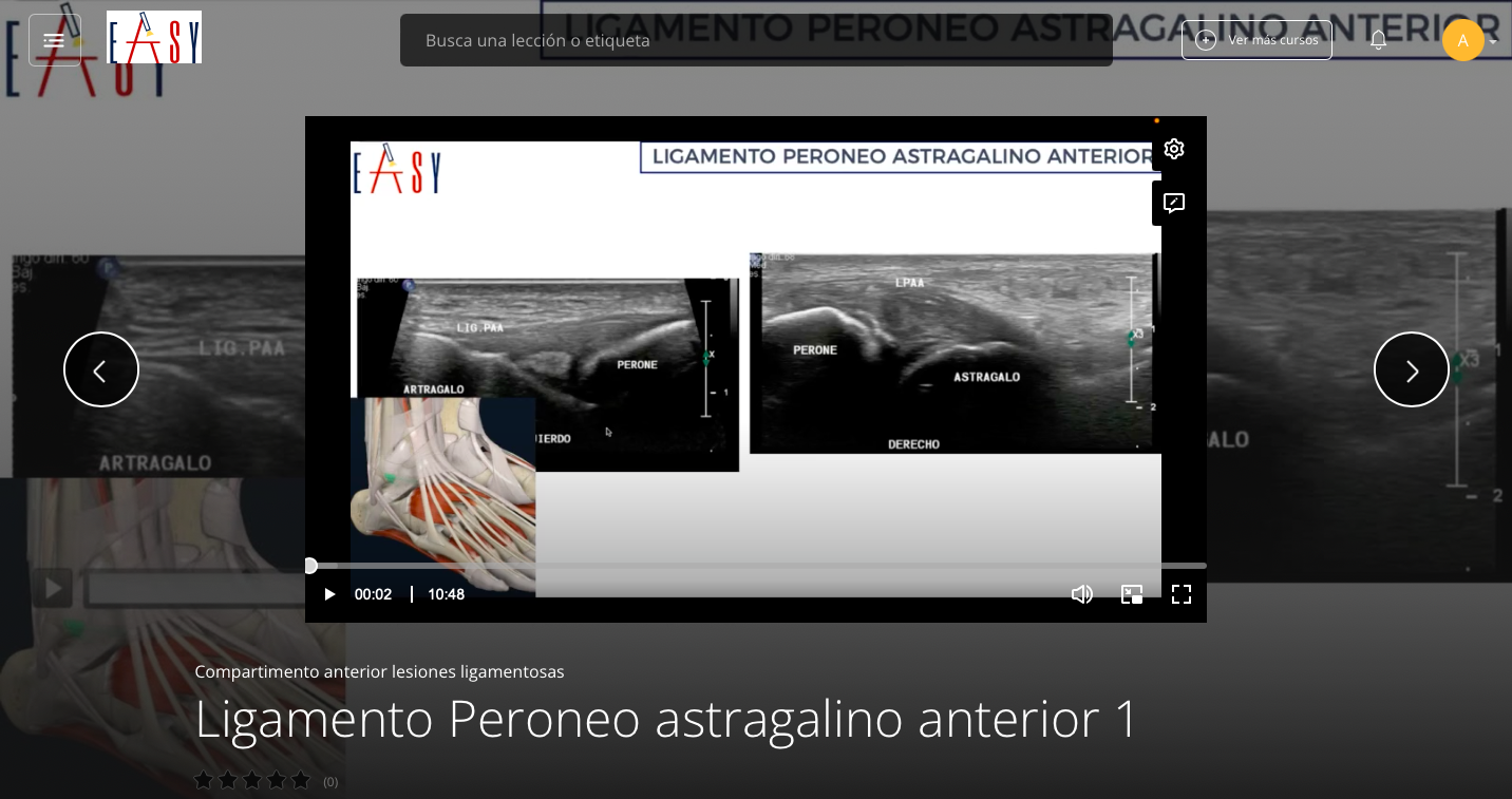 Patología del Comportamiento Anterior Lesiones Ligamentosas del TOBILLO