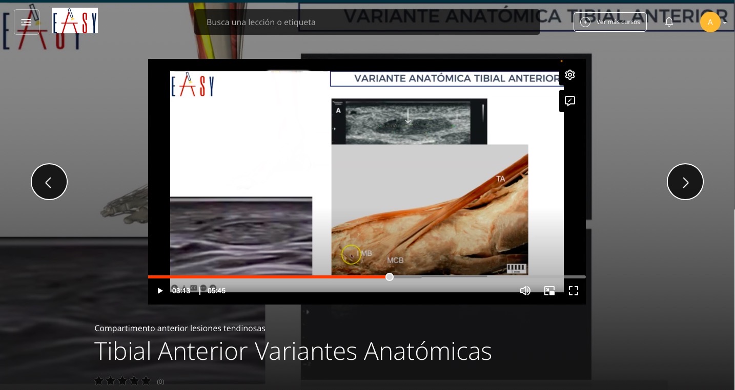 Patología del Compartimento Anterior Lesiones Tendinosas del TOBILLO