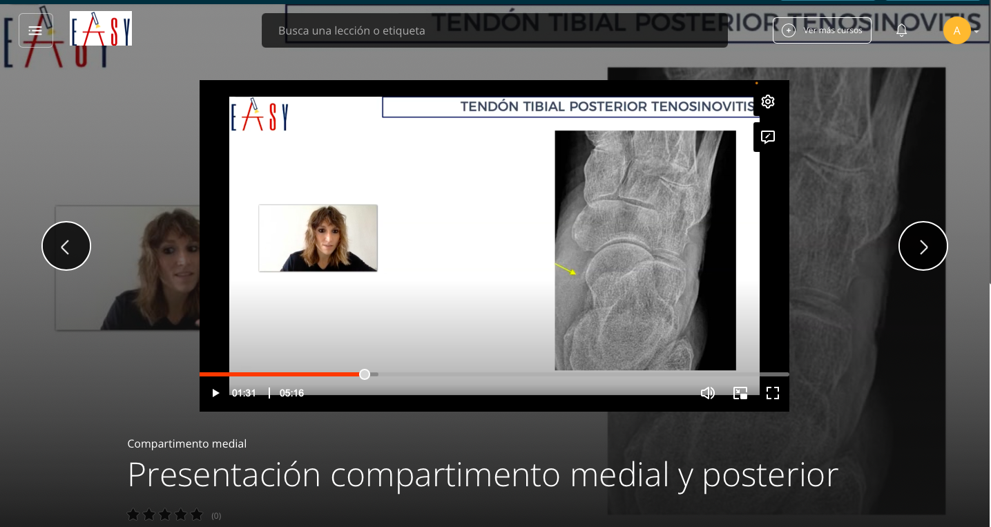 Patología del Compartimento Medial del TOBILLO