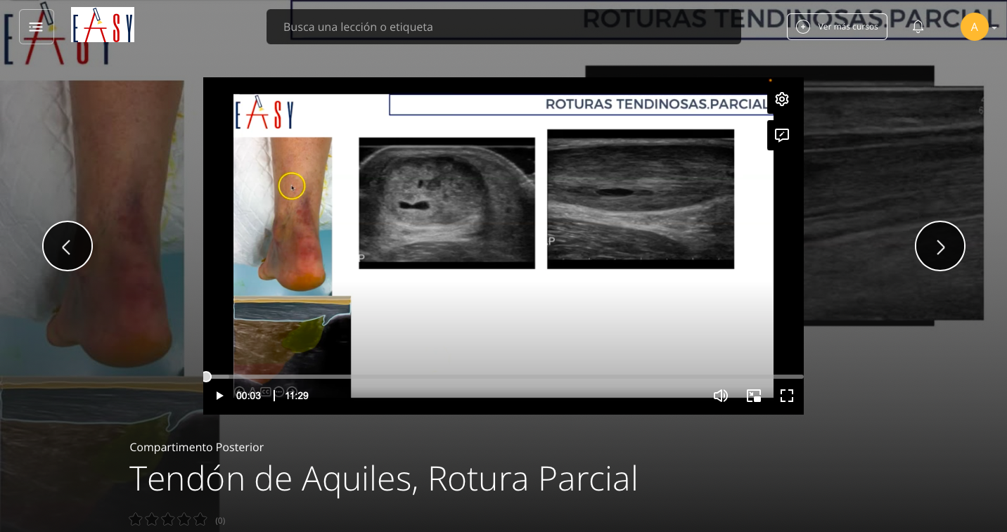 Patología del Compartimento Posterior del TOBILLO