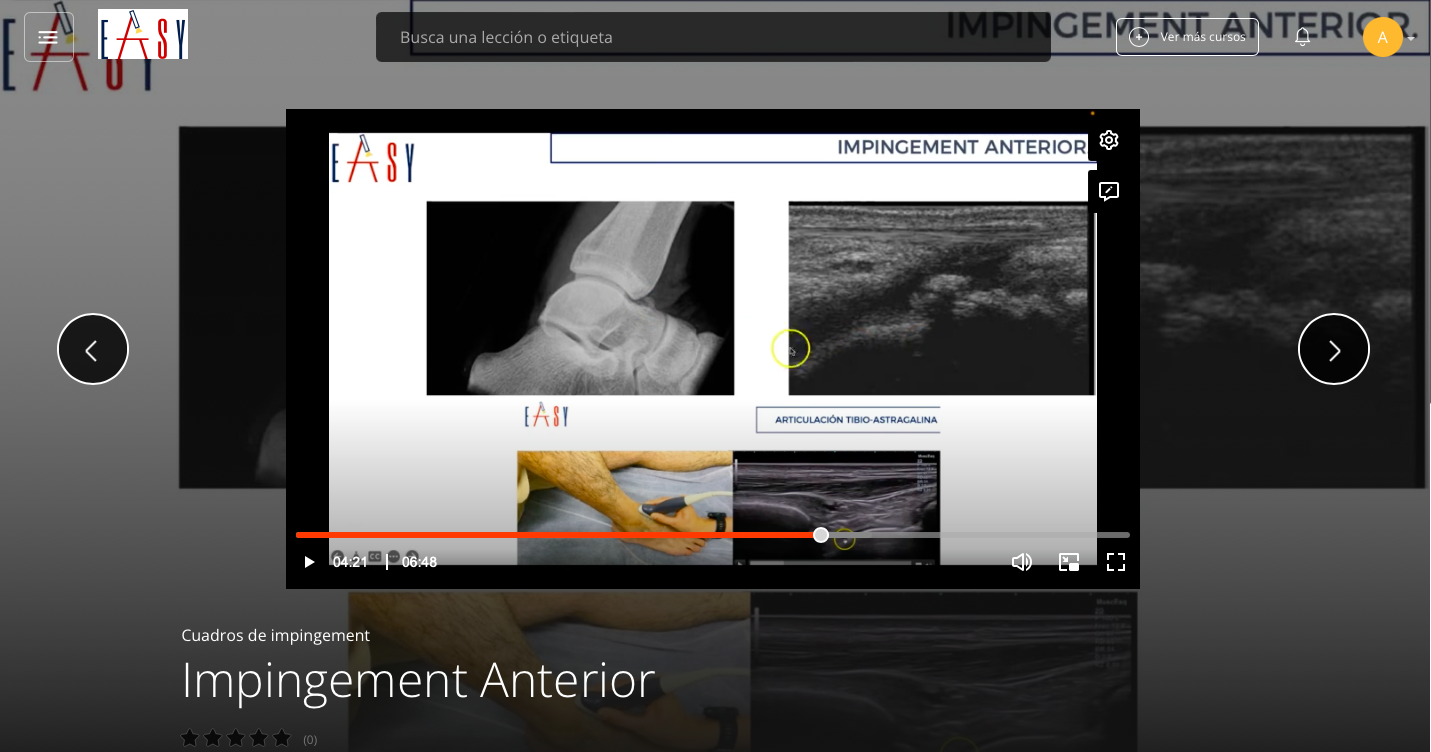 Cuadros de Impingement