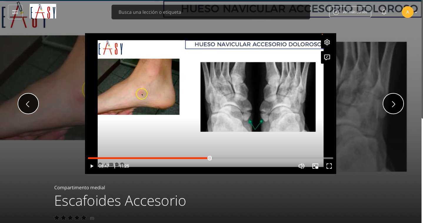 Compartimento Medial del Pie