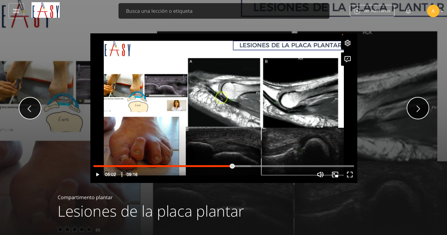 Compartimento Plantar del Pie