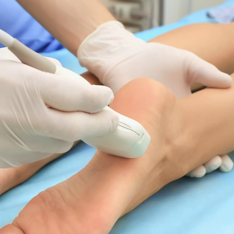  ecografía patológica pie y tobillo