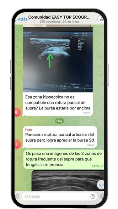 Telegram Comunidad Privada