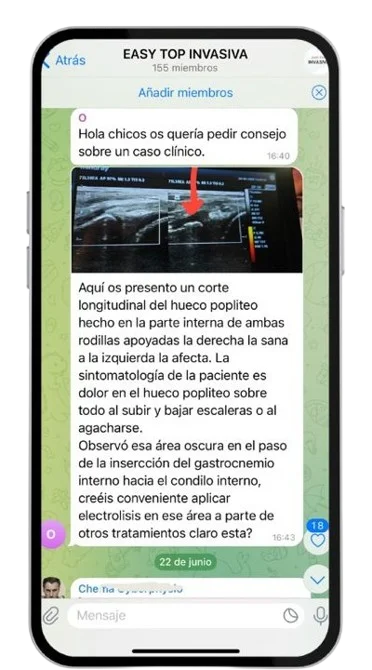 Telegram Comunidad Privada