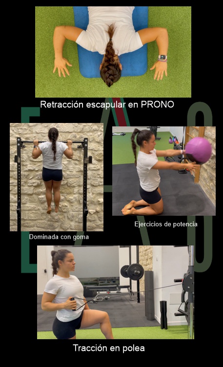 La capsulitis de hombro, también conocida como hombro congelado, es una afección que se produce cuando la cápsula articular del hombro se inflama y se endurece, causando dolor y limitando la movilidad del hombro