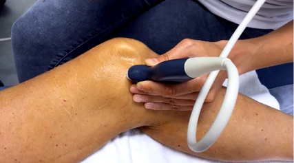 La ecografía de menisco es el procedimiento de diagnóstico que se utiliza comúnmente para evaluar las lesiones en los meniscos de la rodilla.