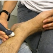 nervio-tibial-1 La ecografia del nervio tibial posterior debes saber hacerla para poder detectar cambios tanto en el tendón como en las estructuras adyacentes