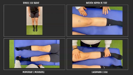 Las plica sinovial alrededor de la rodilla, son remanentes sinoviales del desarrollo embrionario.

Se conocen desde hace tiempo, pero sigue existiendo controversia sobre su naturaleza patológica y lanecesidad de tratamiento. 