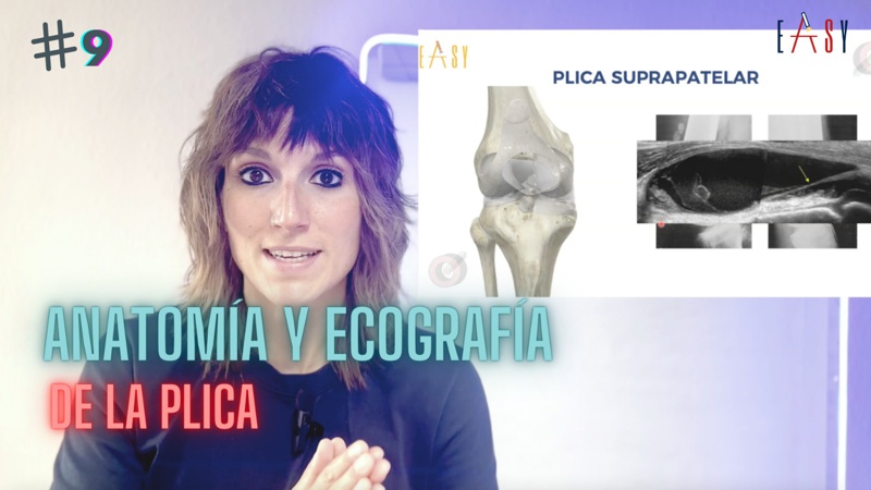Plica sinovial de la rodilla. Ecografía y tratamiento.