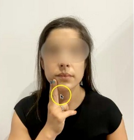 Tratamiento para la articulación temporomandibular o ATM. Ejercicios prácticos Tratamiento para la articulación temporomandibular o ATM. Ejercicios prácticos