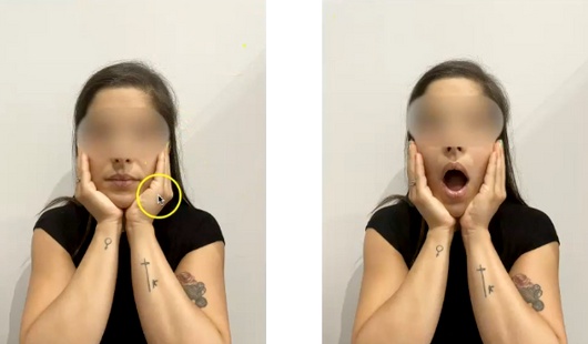Tratamiento para la articulación temporomandibular o ATM. Ejercicios prácticos Tratamiento para la articulación temporomandibular o ATM. Ejercicios prácticos