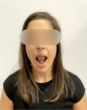 Tratamiento para la articulación temporomandibular o ATM. Ejercicios prácticos Tratamiento para la articulación temporomandibular o ATM. Ejercicios prácticos