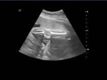 Regula la profunidad en la imagen de tu ecógrafo