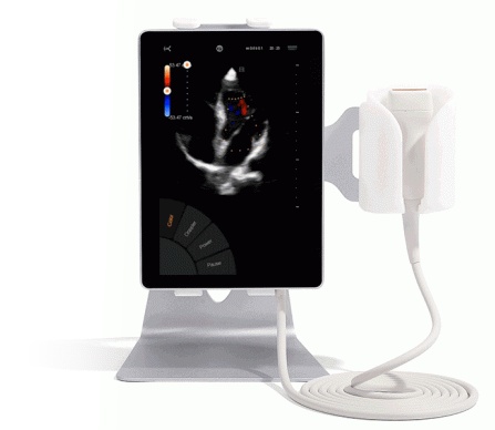 Comprar un ecógrafo como herramienta de trabajo. Equipo ultraportátil