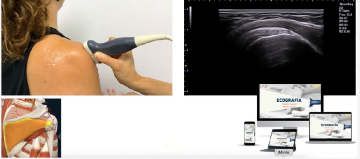 Corte de referencia en ecografía del labrum posterior del hombro