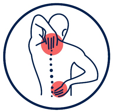 El dolor lumbar es la patología de dolor músculoesquelético más prevalente entre la población adulta