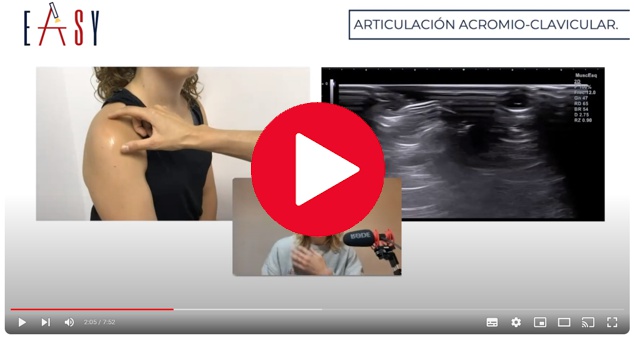 La articulación acromioclavicular es una articulación prácticamente plana cuya función principal es realizar ajustes durante la báscula escapular para que el movimiento de nuestro hombro sea congruente La articulación acromioclavicular es una articulación prácticamente plana cuya función principal es realizar ajustes durante la báscula escapular para que el movimiento de nuestro hombro sea congruente