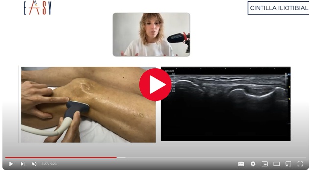 Video explicativo de la ecografía de la cintilla Video explicativo de la ecografía de la cintilla