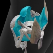 El quiste de Baker es un acúmulo de líquido sinovial situado en la parte posterior de la rodilla. Relacionado con trastornos de la rodilla