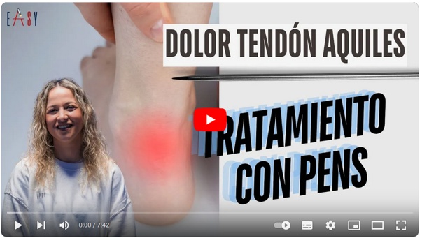 La entesopatía Aquílea es una afección frecuente que afecta la inserción del tendón de aquiles en el hueso calcáneo
