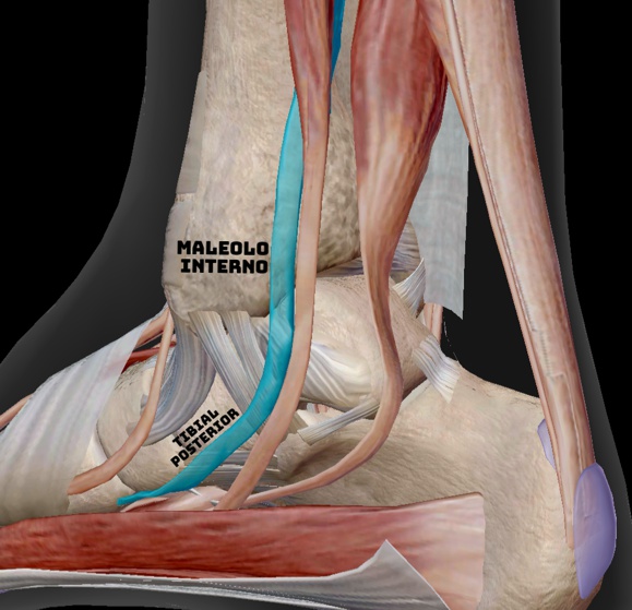 La tenosinovitis del tibial posterior es una afección dolorosa que afecta a uno de los tendones clave en el pie y el tobillo. La tenosinovitis del tibial posterior es una afección dolorosa que afecta a uno de los tendones clave en el pie y el tobillo.