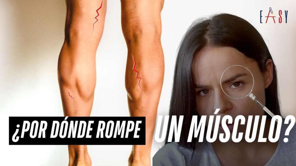Video de rotura muscular