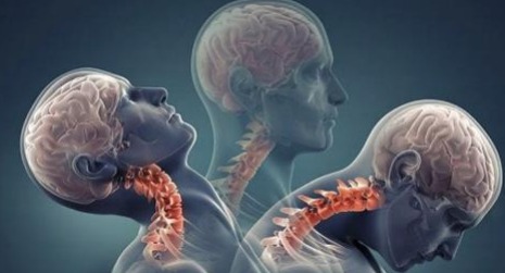 Dolor cervical, no radicular