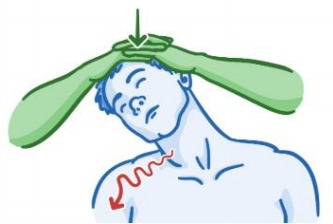 Dolor cervical, prueba de Spurling